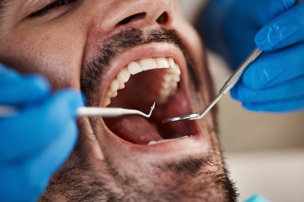 Best Emergency Broken Tooth Repair in Cleveland, MS