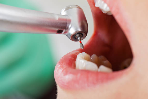 Best Weekend Emergency Dentist in Cleveland, MS
